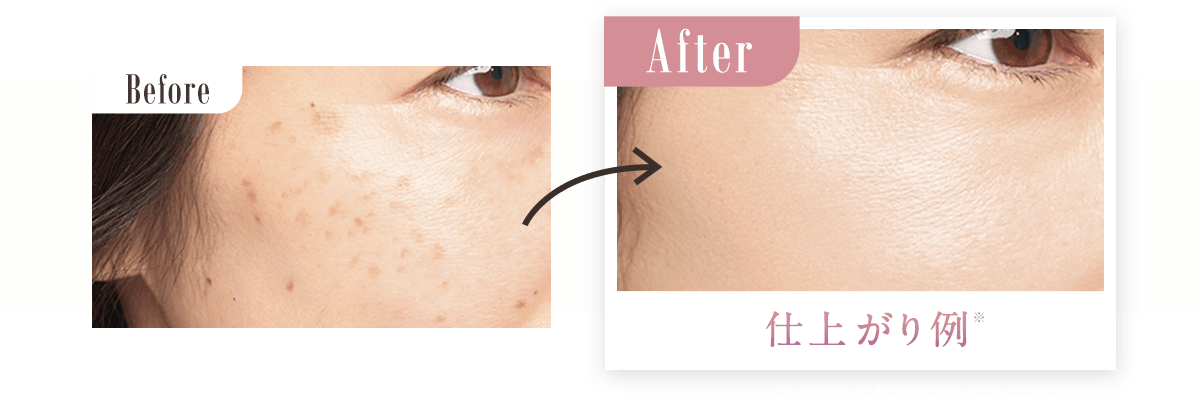 Before→After画像 ※メイクアップ効果によるものです。効果には個人差があります。